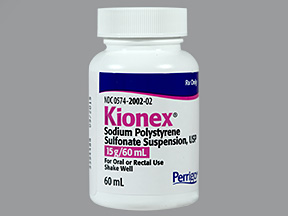 KIONEX